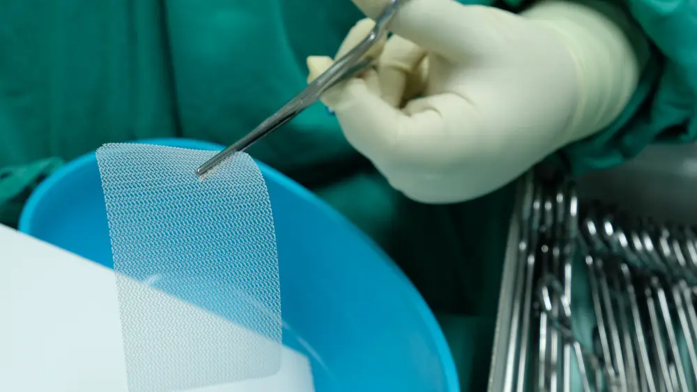 hernia mesh removal surgery